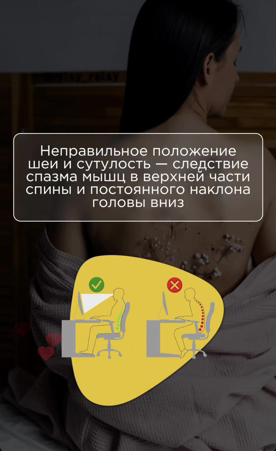 Неправильное положение шеи и сутулость — следствие спазма мышц в верхней части спины и постоянного наклона головы вниз.