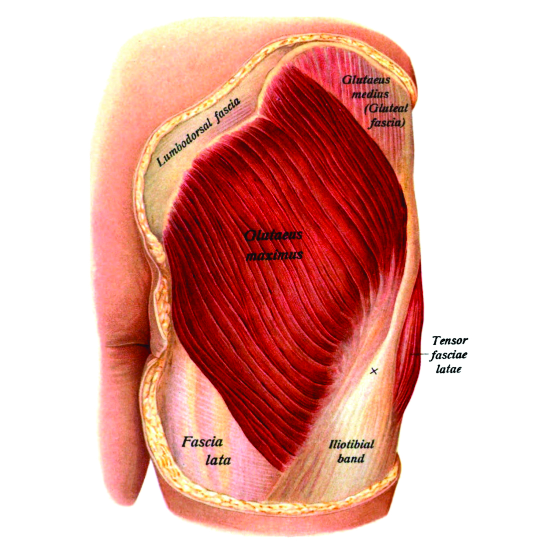 Gluteus Maximus мышца