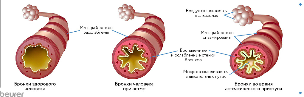 https://4gkb.ru/wp-content/uploads/2022/05/bronh.png