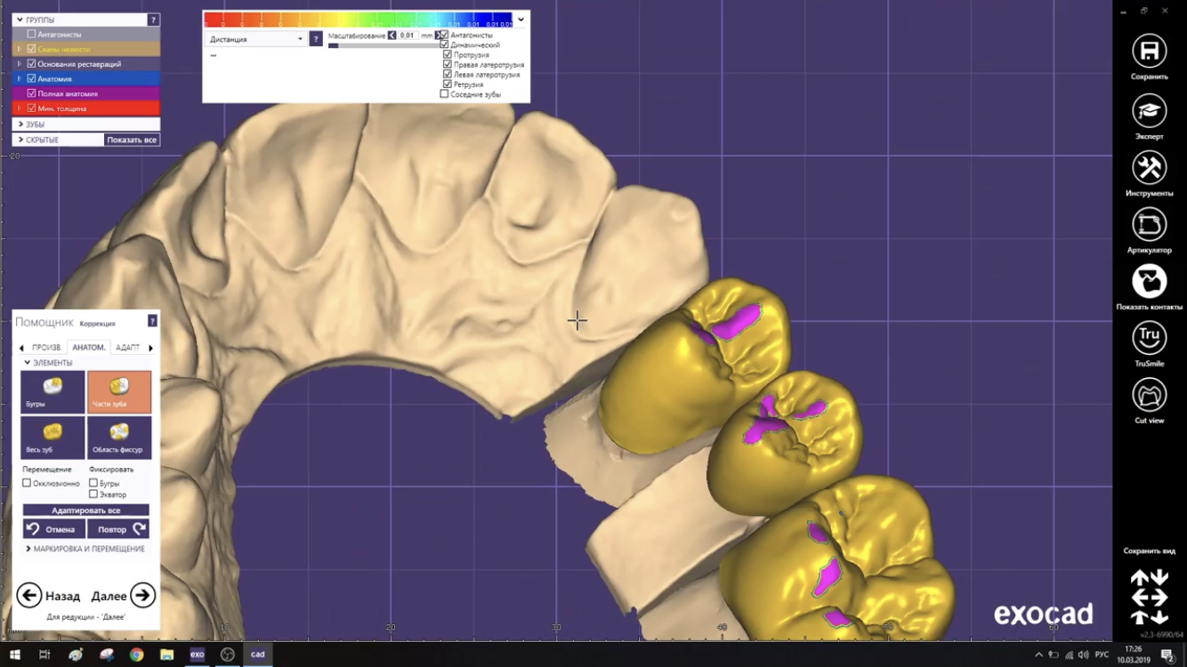 Exocad моделирование зубов. Программное обеспечение cad cam хирургический модуль. Exocad программа. Пловдив exocad. Библиотека exocad green.