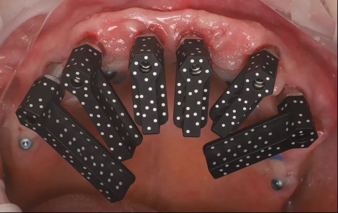 фотограметрия