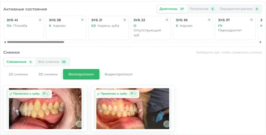 Материалы по зубу — Future IT Dent
