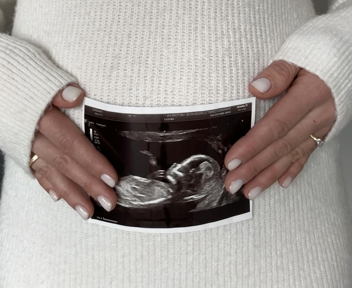 донорство яйцеклеток — беременность как результат программы