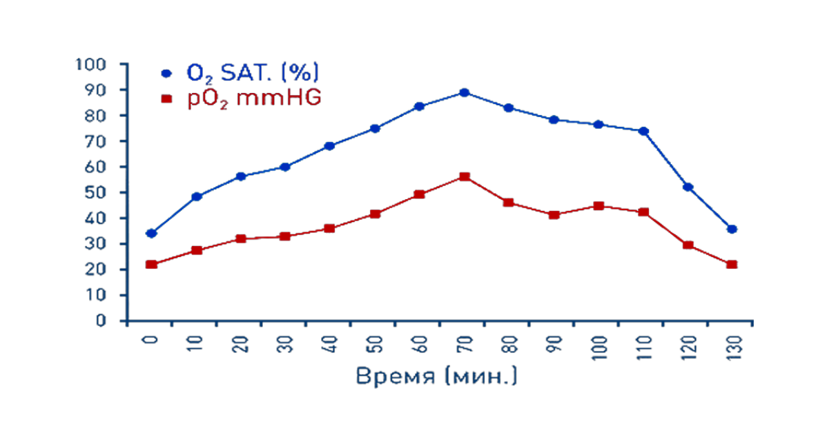 Динамика улучшения. Динамика повышения.