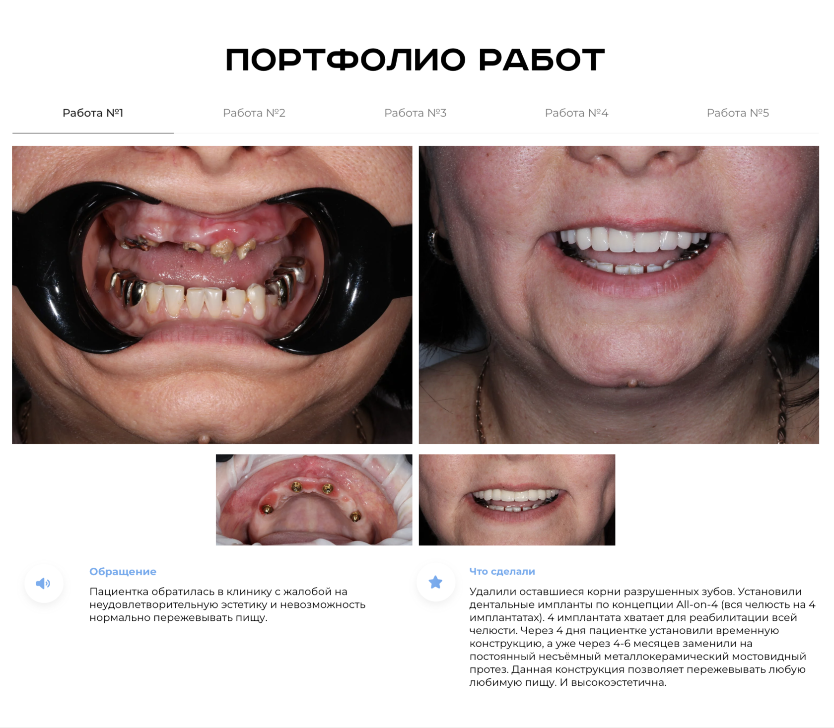 Портфолио работ - Стоматология Савченко