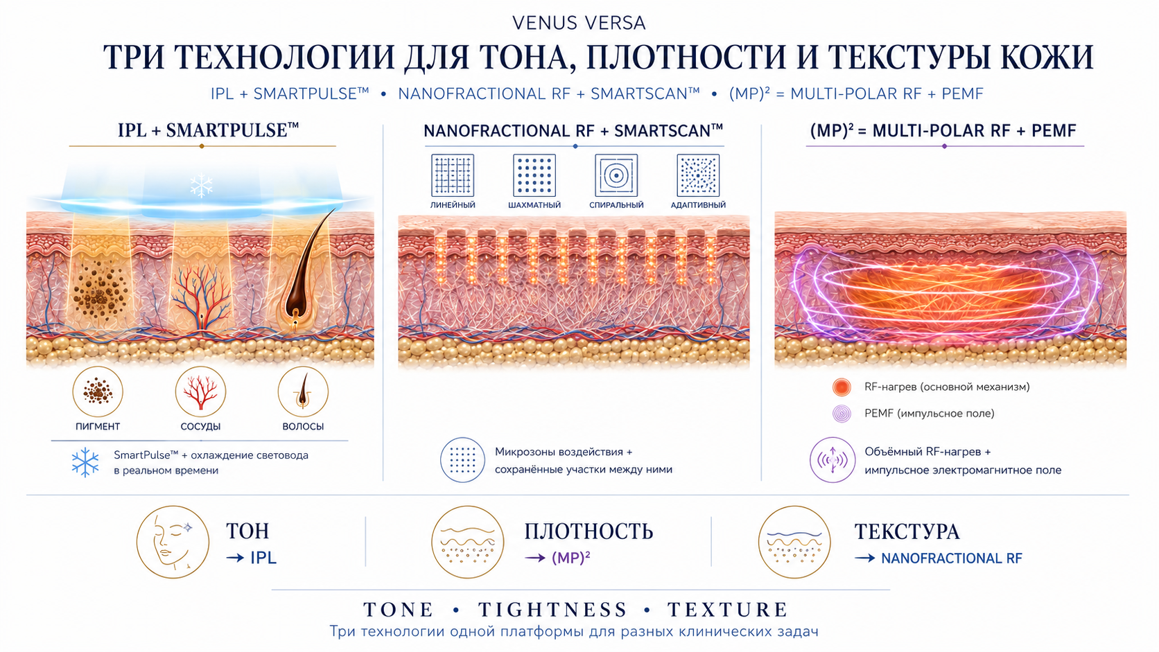 Venus Versa: схема технологий