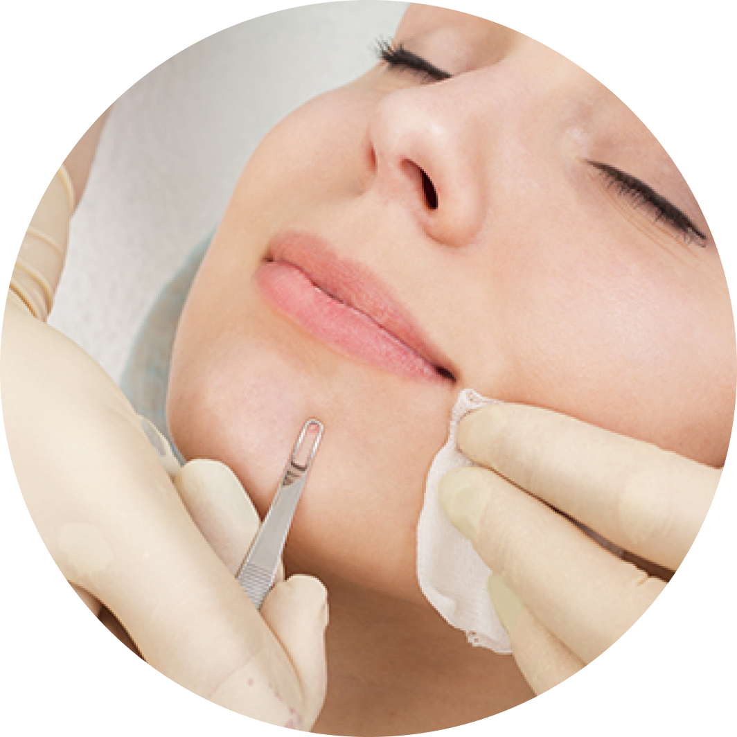 Чистка лица в клинике косметологии Inteskin во Владивостоке