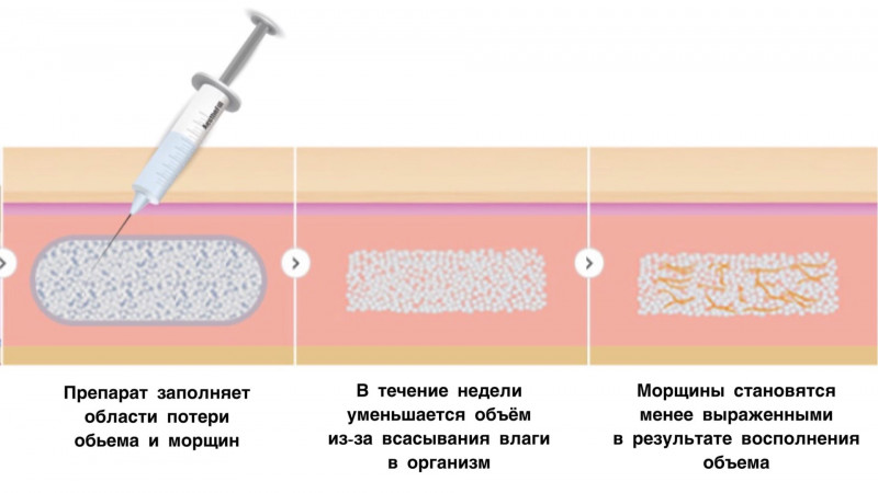 Эстефил Препарат Цена