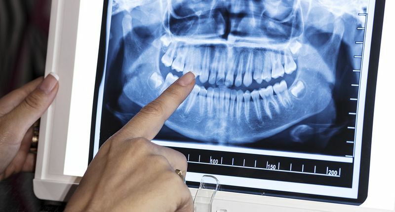 На рентгене под жевательными зубами темное пятно, это может быть причиной боли в челюсти?