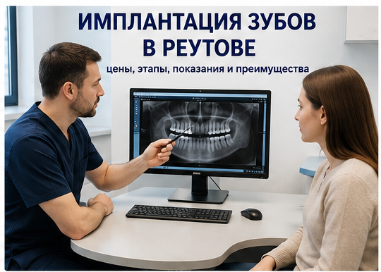 Имплантация зубов в Реутове — консультация стоматолога-имплантолога