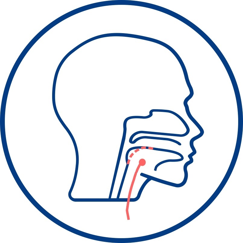 Bipap-терапия и что такое BiPAP-терапия? Его отличие от СИПАП-терапии