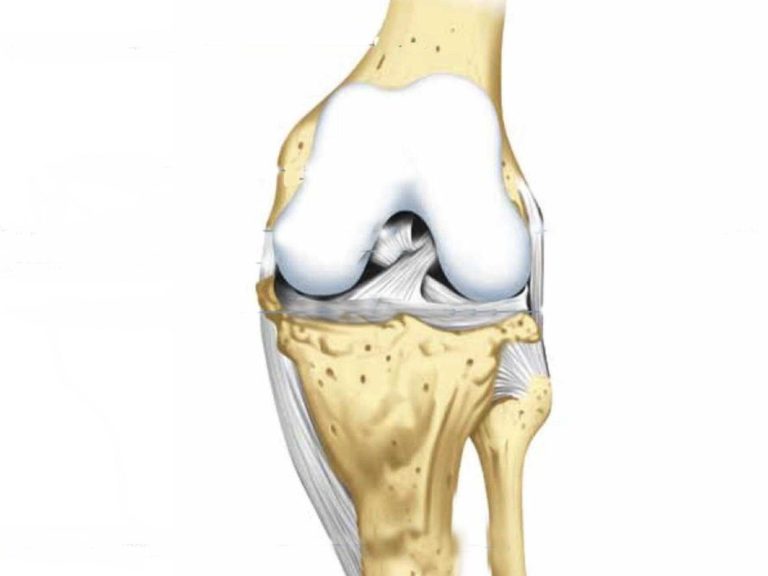 Недостаток жидкости в коленном суставе: причины, диагностика и лечение