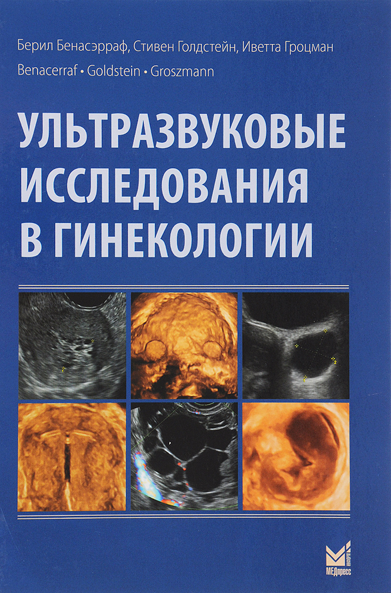 Стандартизация ультразвукового исследования. Ультразвуковое исследование матки и придатков. Стандартизация ультразвукового исследования. Стандартизация ультразвукового исследования. Стандартизация ультразвукового исследования.