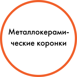 Установка имплантов в Дербенте. Имплантация при отсутствии одного зуба.