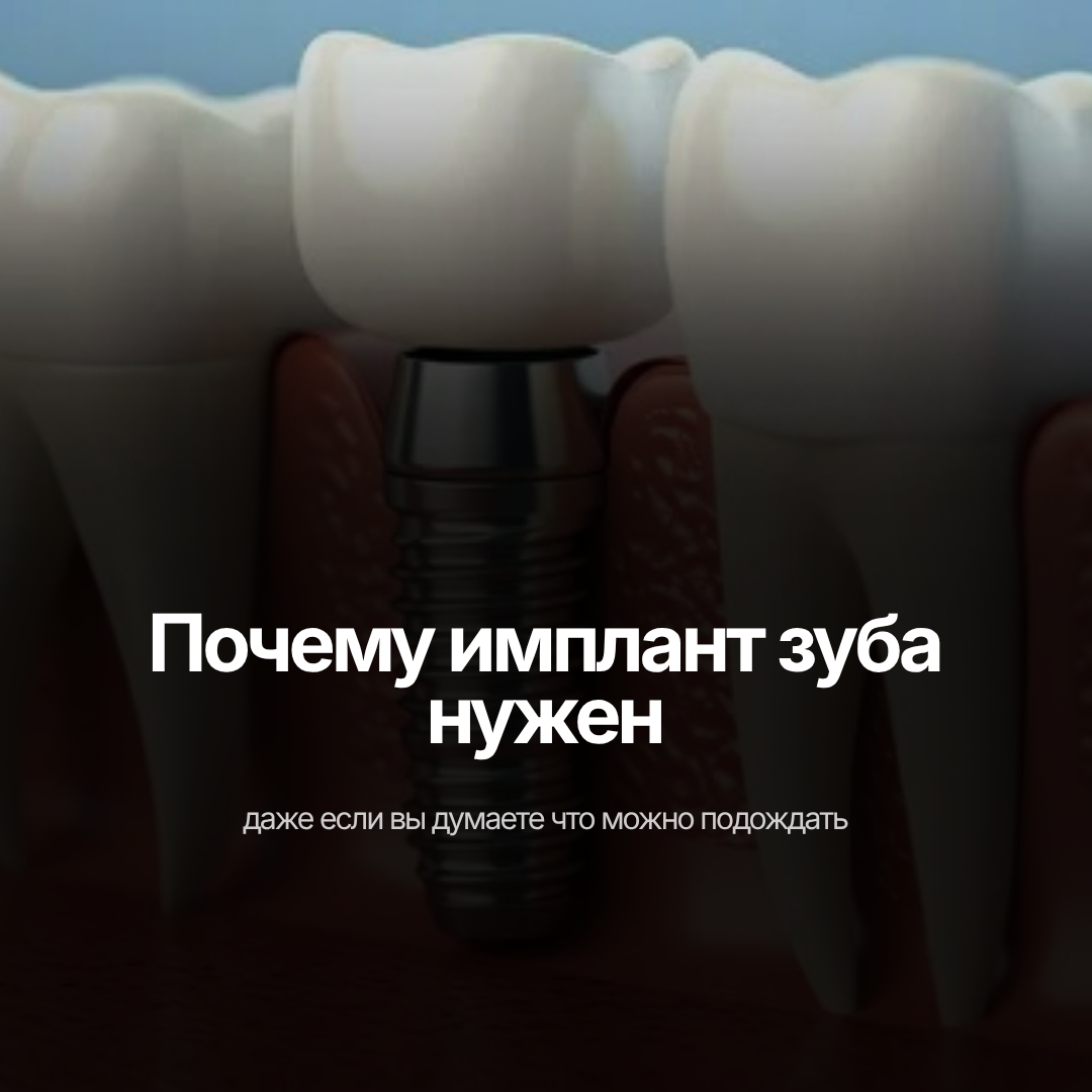 Зачем нужен имплант зуба