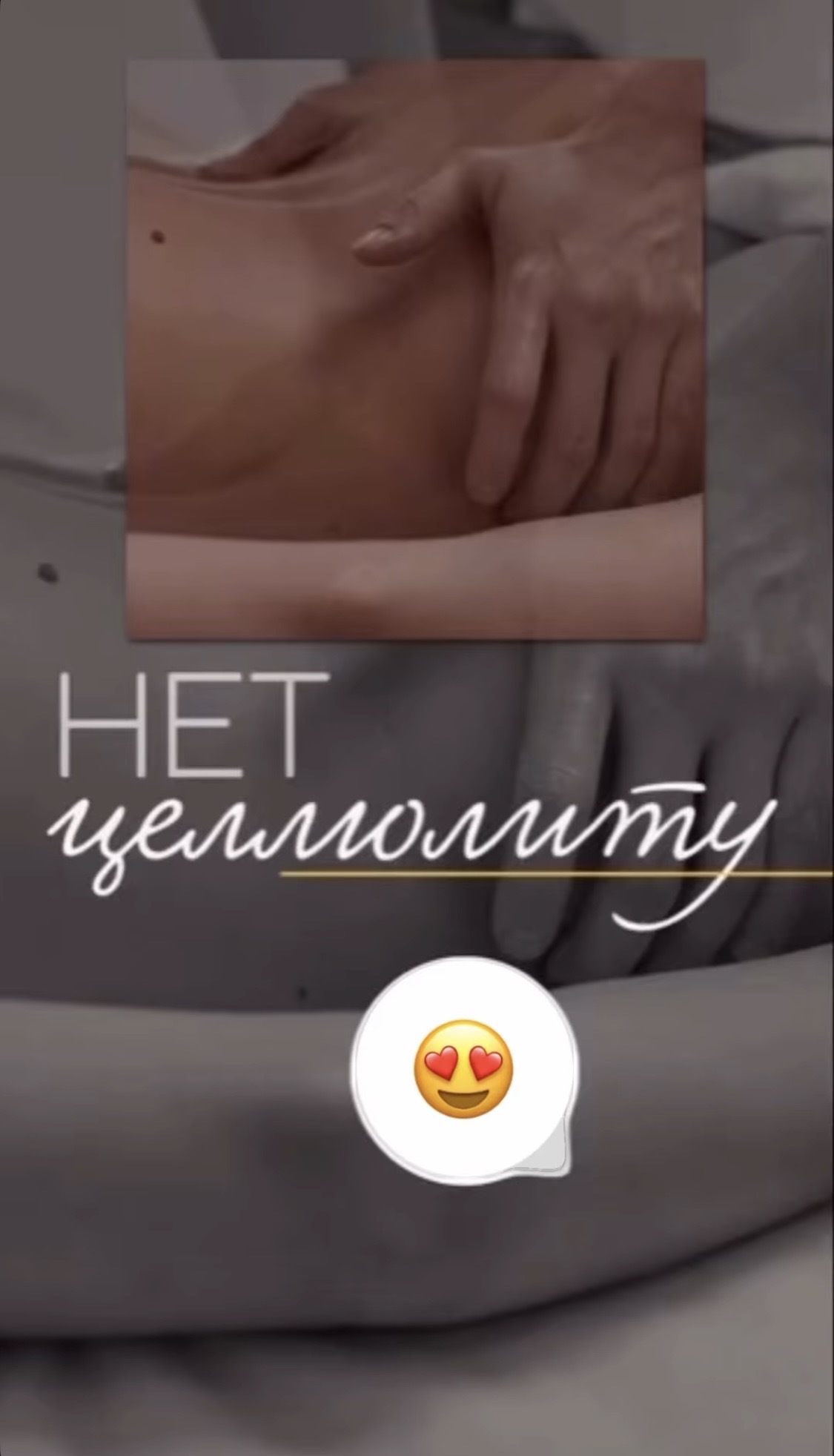 Нет целлюлиту!