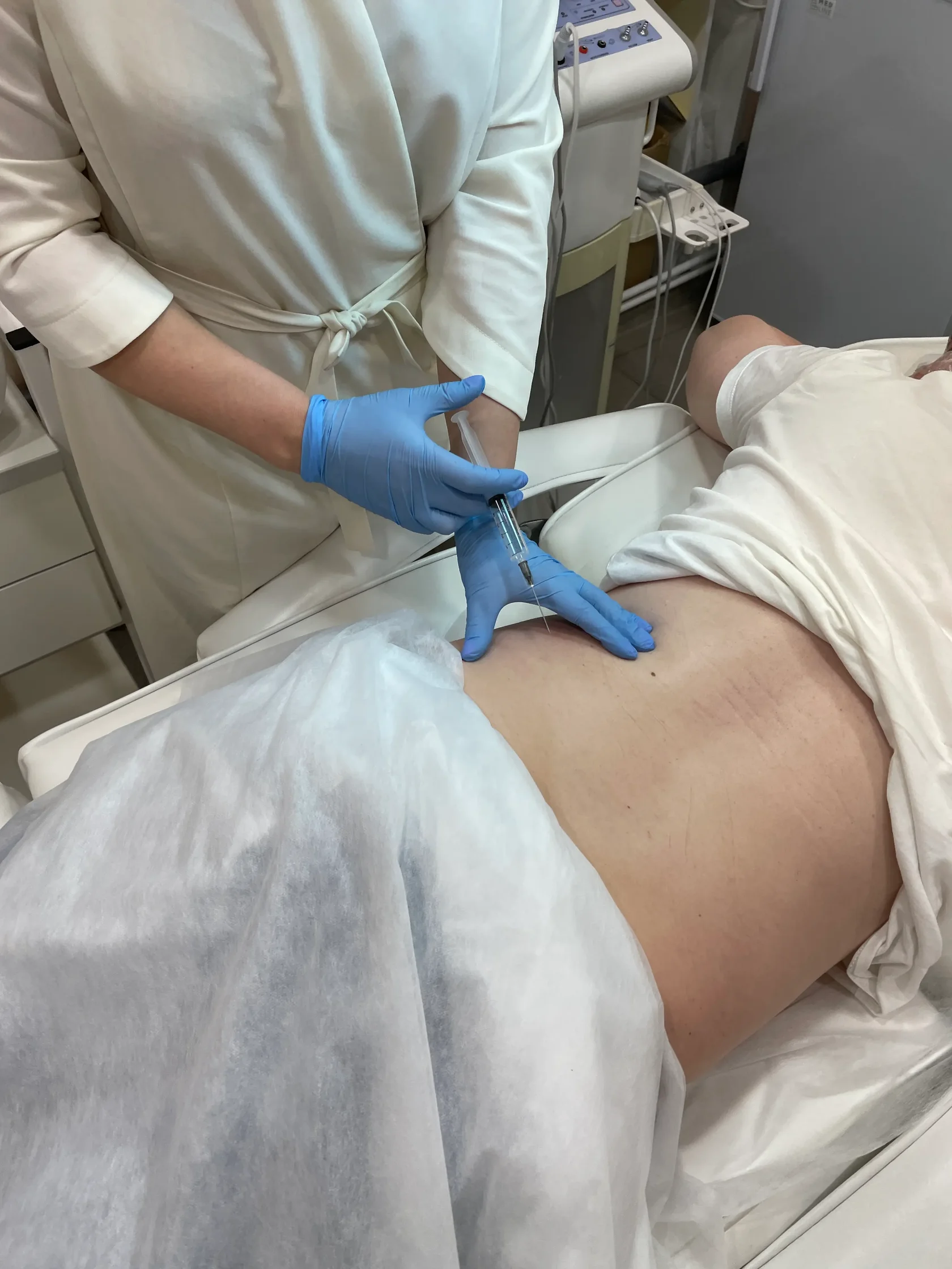 процедура Акваликс в клинике Лаванда Екатеринбург