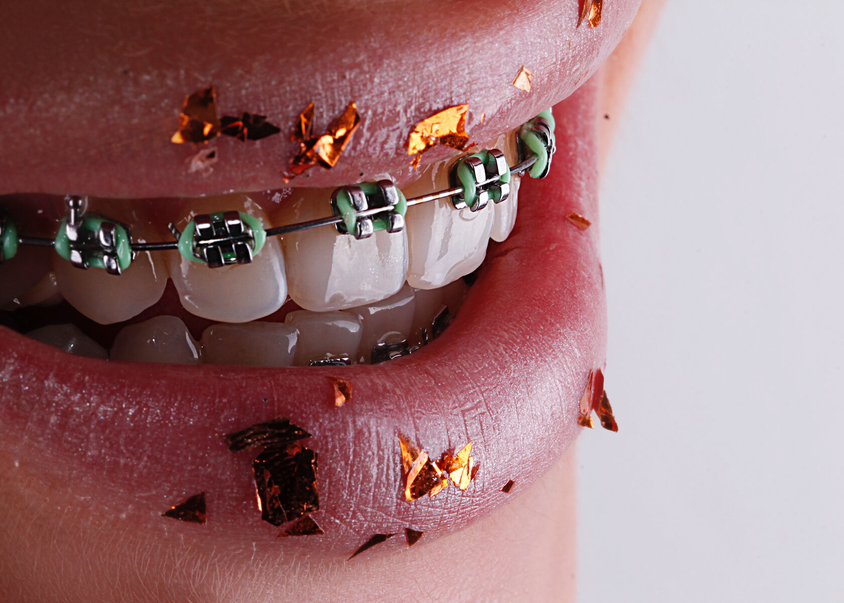 Smile gallery новосибирск отзывы. Smile gallery. Smile gallery стоматология новосибирск. Smile gallery. Smile gallery, новосибирск.