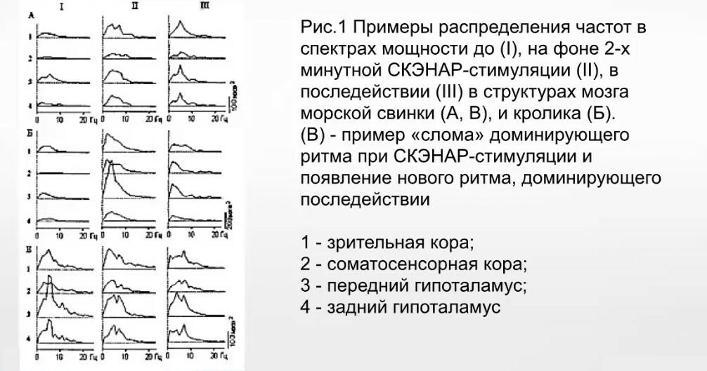 Как работает электростимуляция — суть лечения