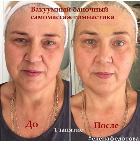 Елена Федотова гимнастика для лица