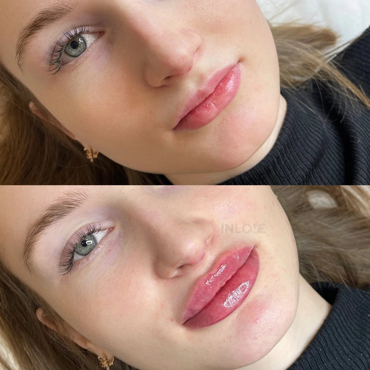Материал из портфолио Inlove Beauty