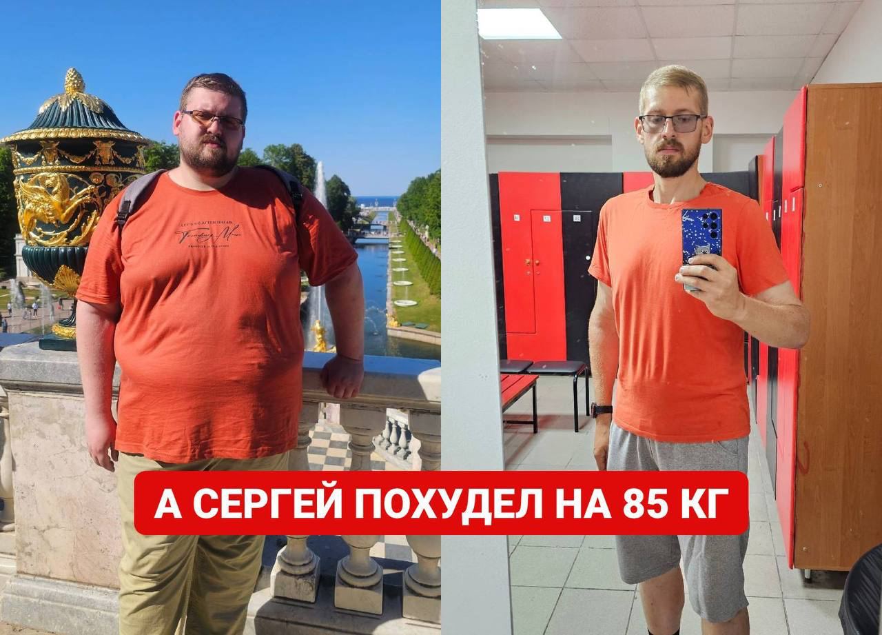 Сергей — фото до и после