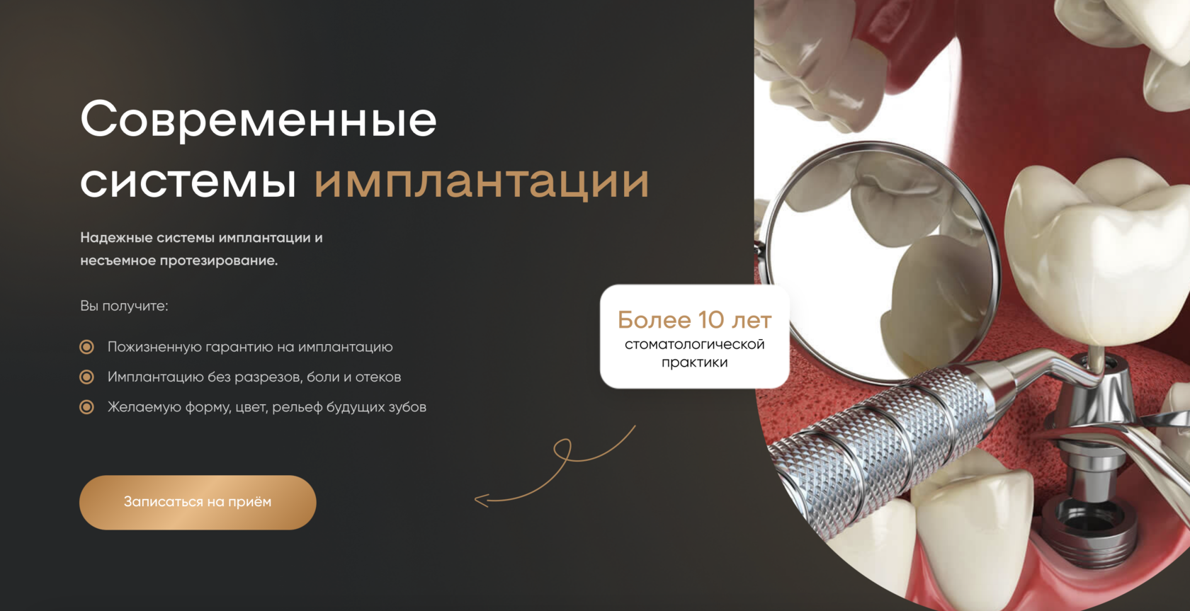 Все виды имплантации в одном центре в Санкт-Петербурге