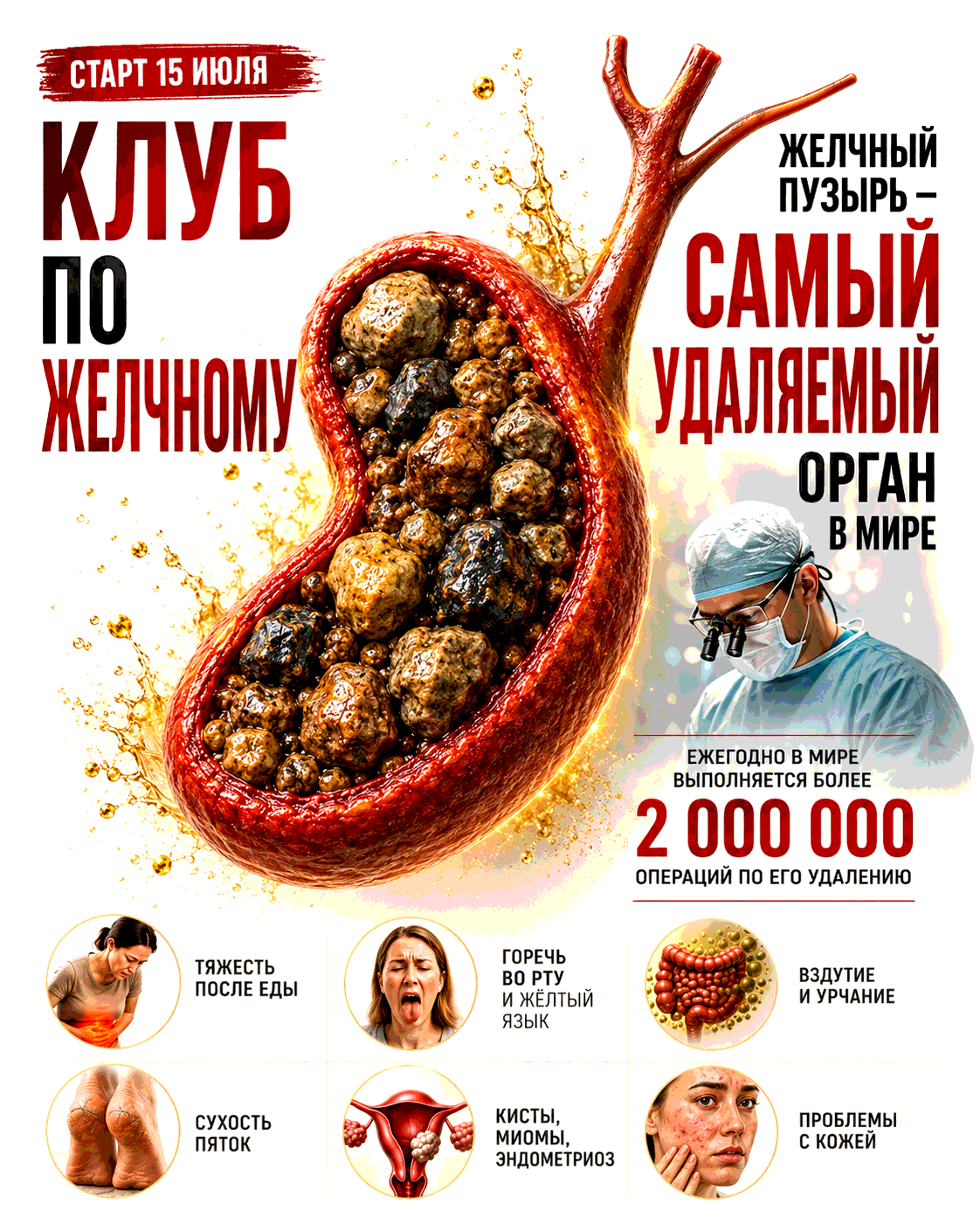 Клуб по желчному