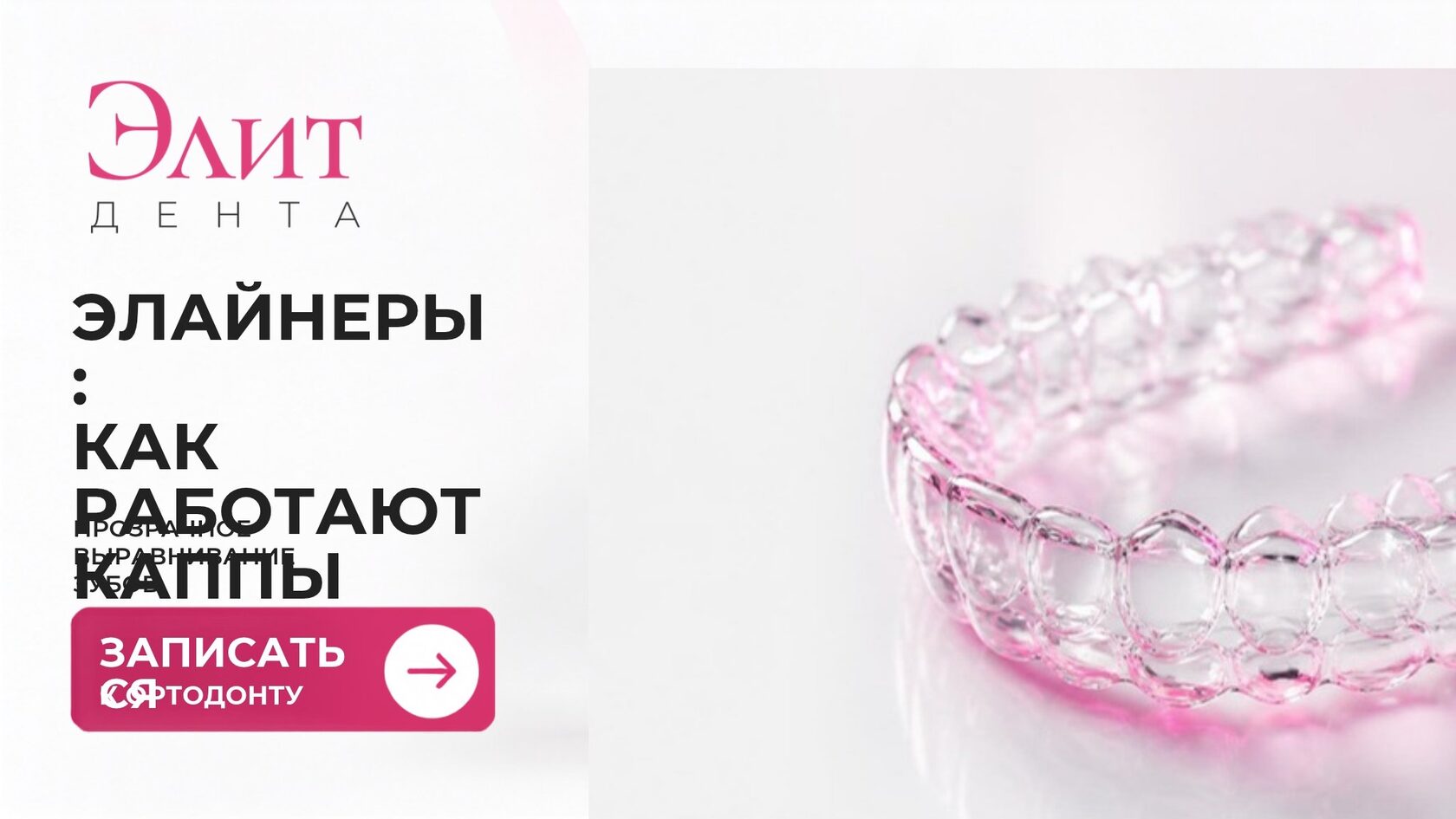 Элайнеры для выравнивания зубов