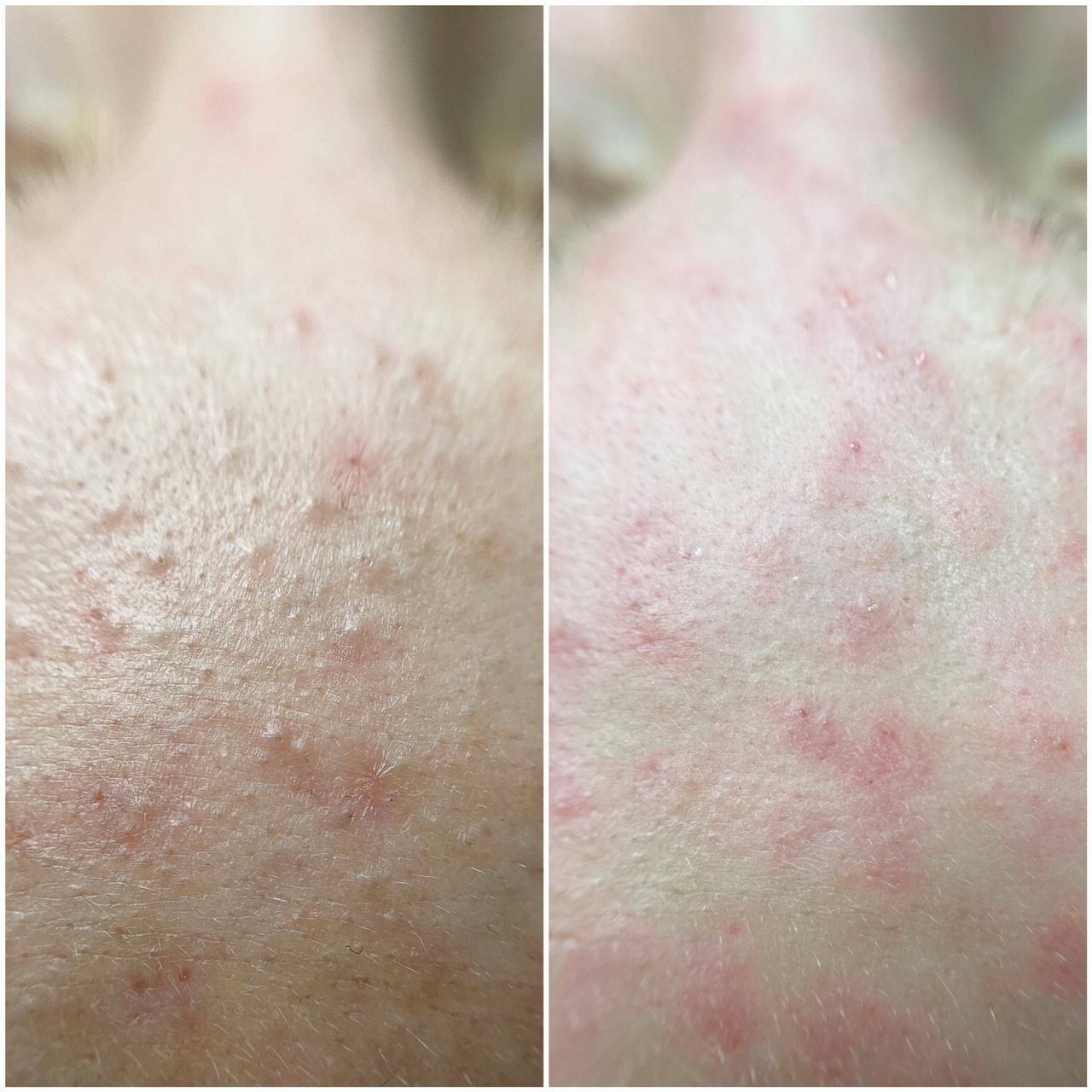 ДО/ПОСЛЕ ЭСТЕТИЧЕСКИХ ПРОЦЕДУР