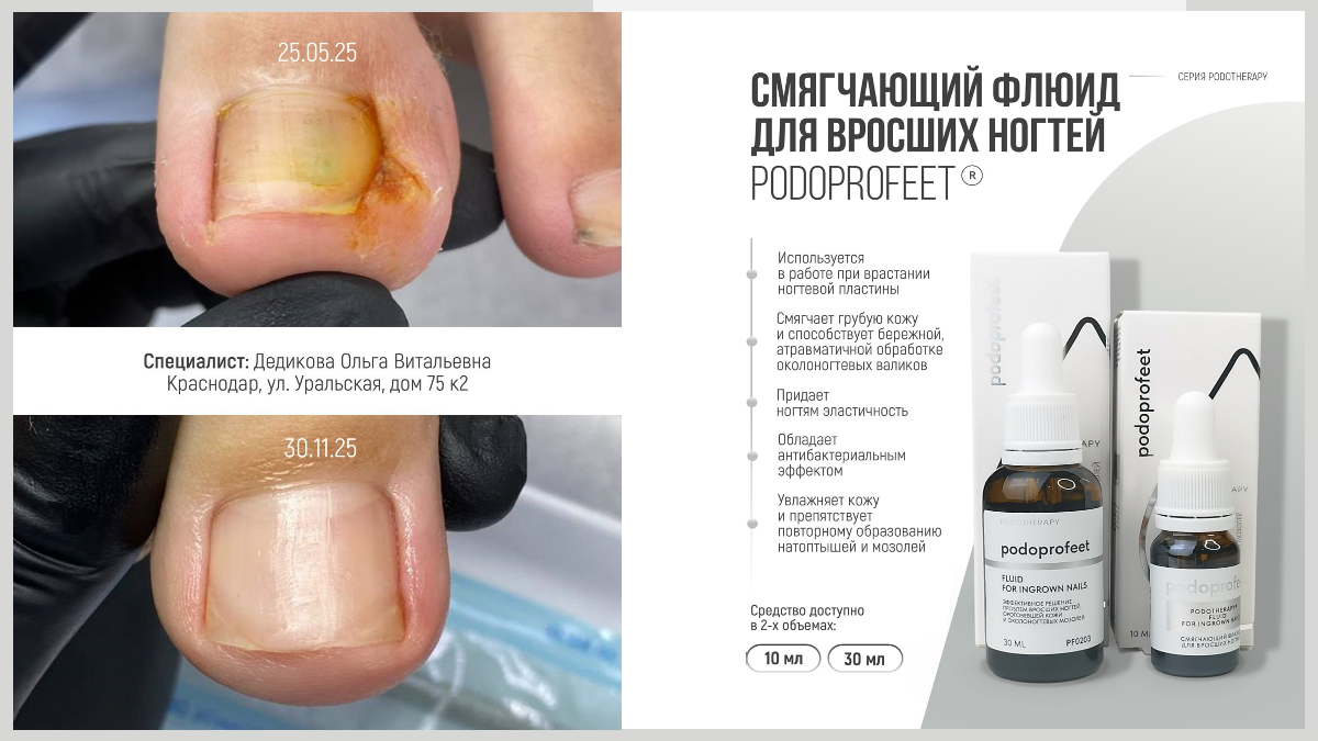 Косметика для подологов