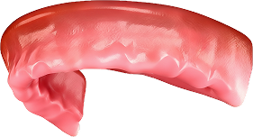 Верхняя челюсть