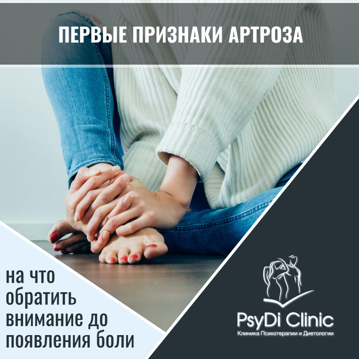 Первые признаки артроза: на что обратить внимание до появления боли