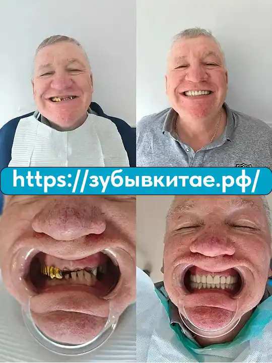 До и после — кейс 4