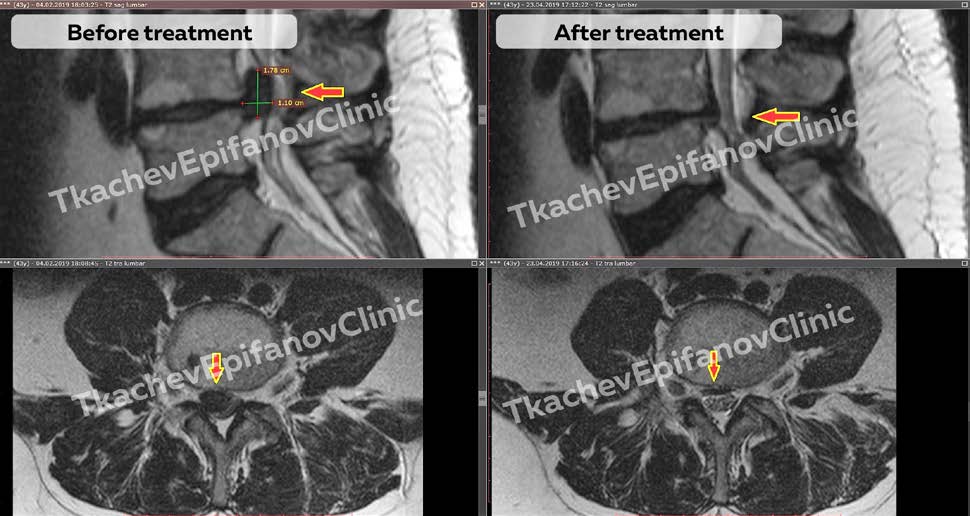 About resorption Innovating approaches based on science