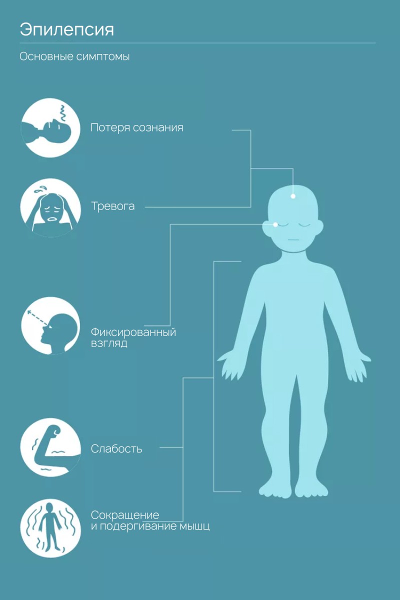 Эпилепсия: причины, симптомы, лечение и первая помощь при приступе