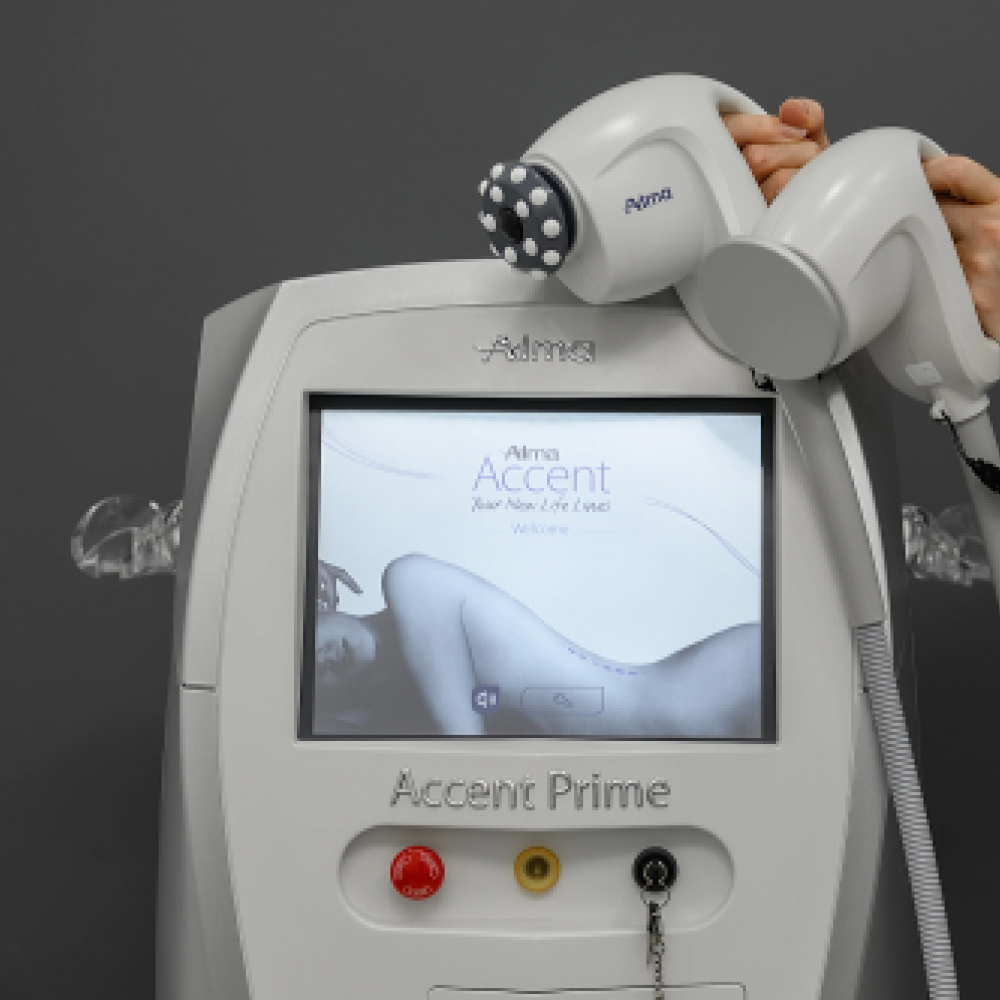 Accent Prime Alma Laser