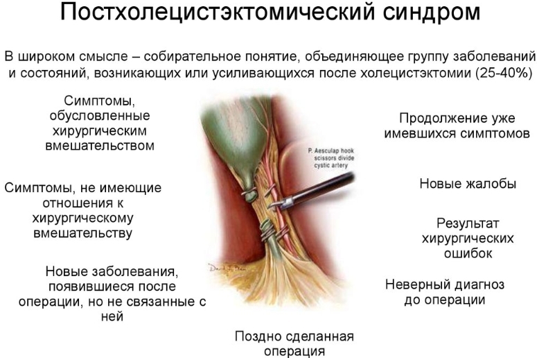 Постхолецистэктомический синдром: симптомы, лечение, рекомендации | «Центр Болотова»