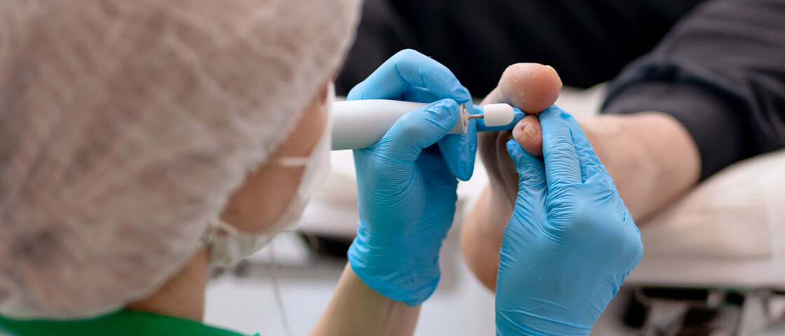 подологический педикюр, лечебный педикюр, эстетический педикюр, уход за ногами, проблемы стоп, грибковые инфекции, вросший ноготь, мозоли, натоптыши, трещины на пятках, диабетическая стопа, ортопедическая обувь, педикюр для диабетиков, медицинский педикюр