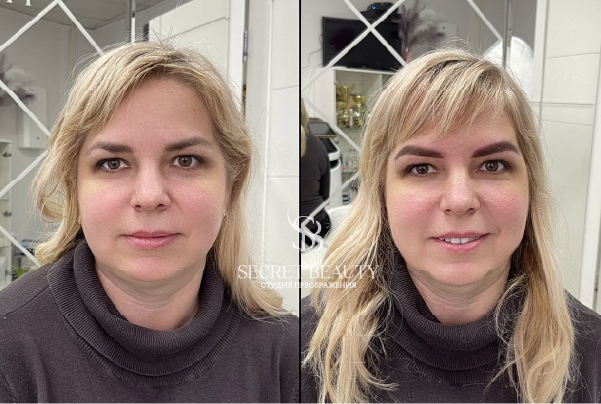 Фото лица до/после
