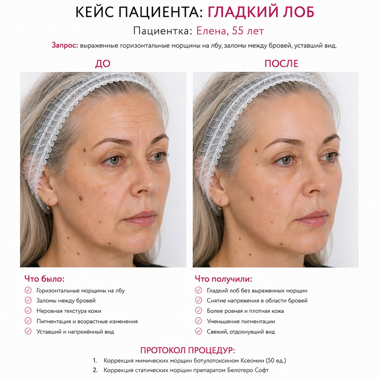 Кейс пациента до и после