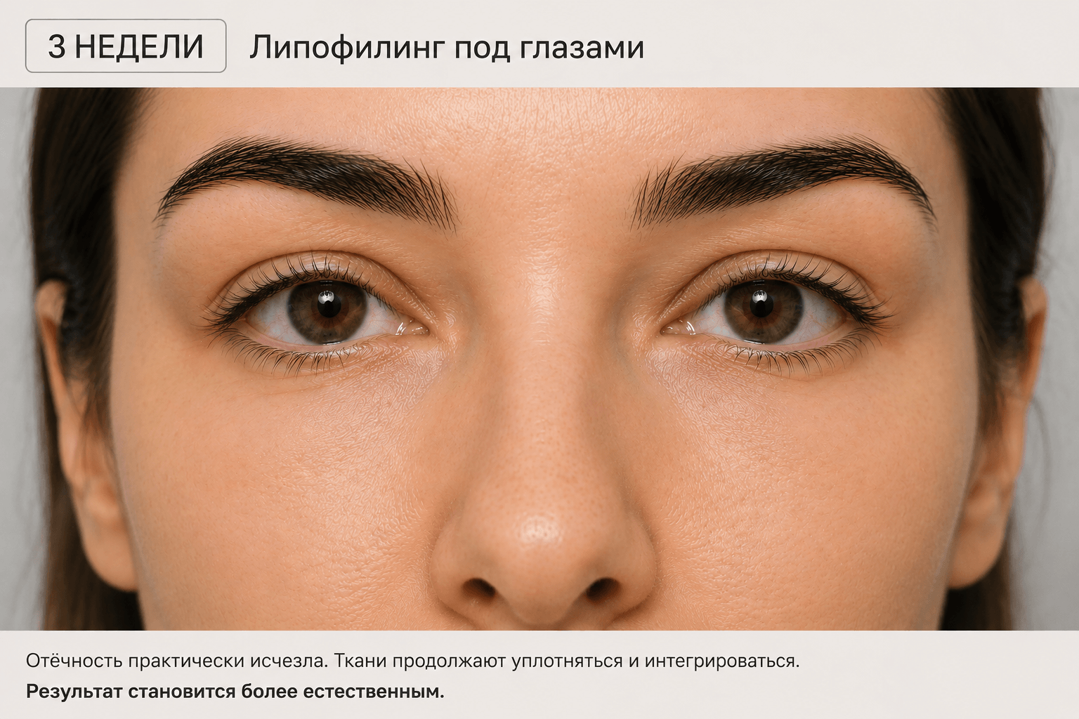 через 3 недели после