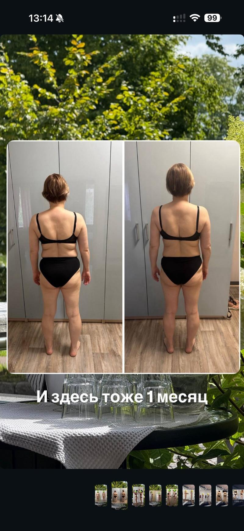 До и после ХМРЗ