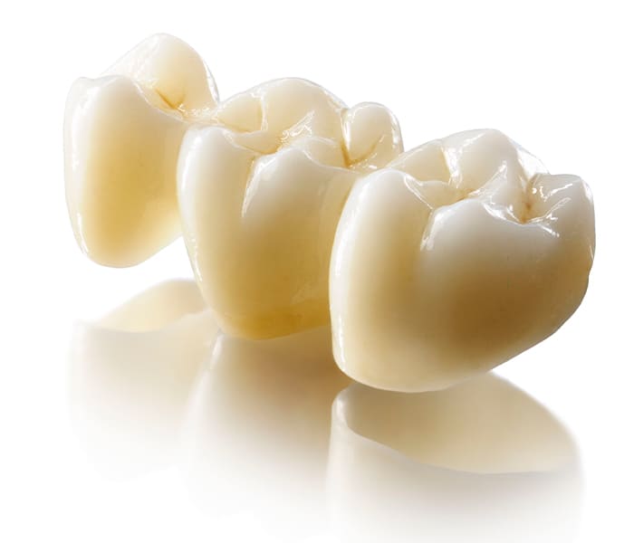 Зубные коронки под ключ в Санкт-Петербурге - Стомаград