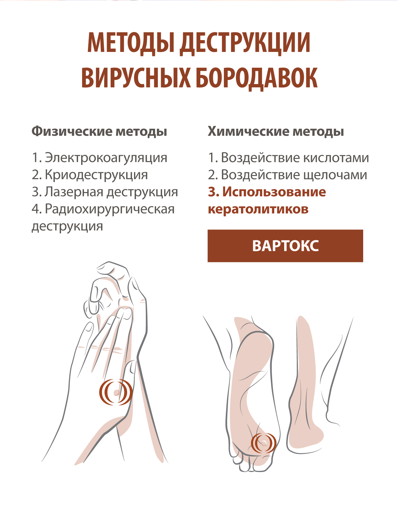Вартокс отзывы. Натоптыши на ступнях психосоматика. Бородавки психосоматика