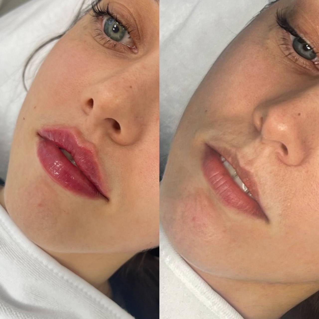 Материал из портфолио Inlove Beauty