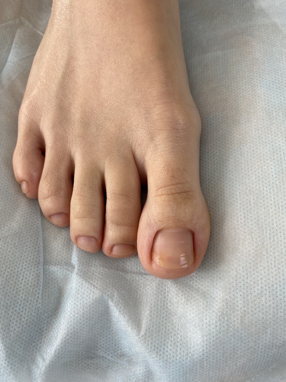 модный педикюр, педикюр дизайн