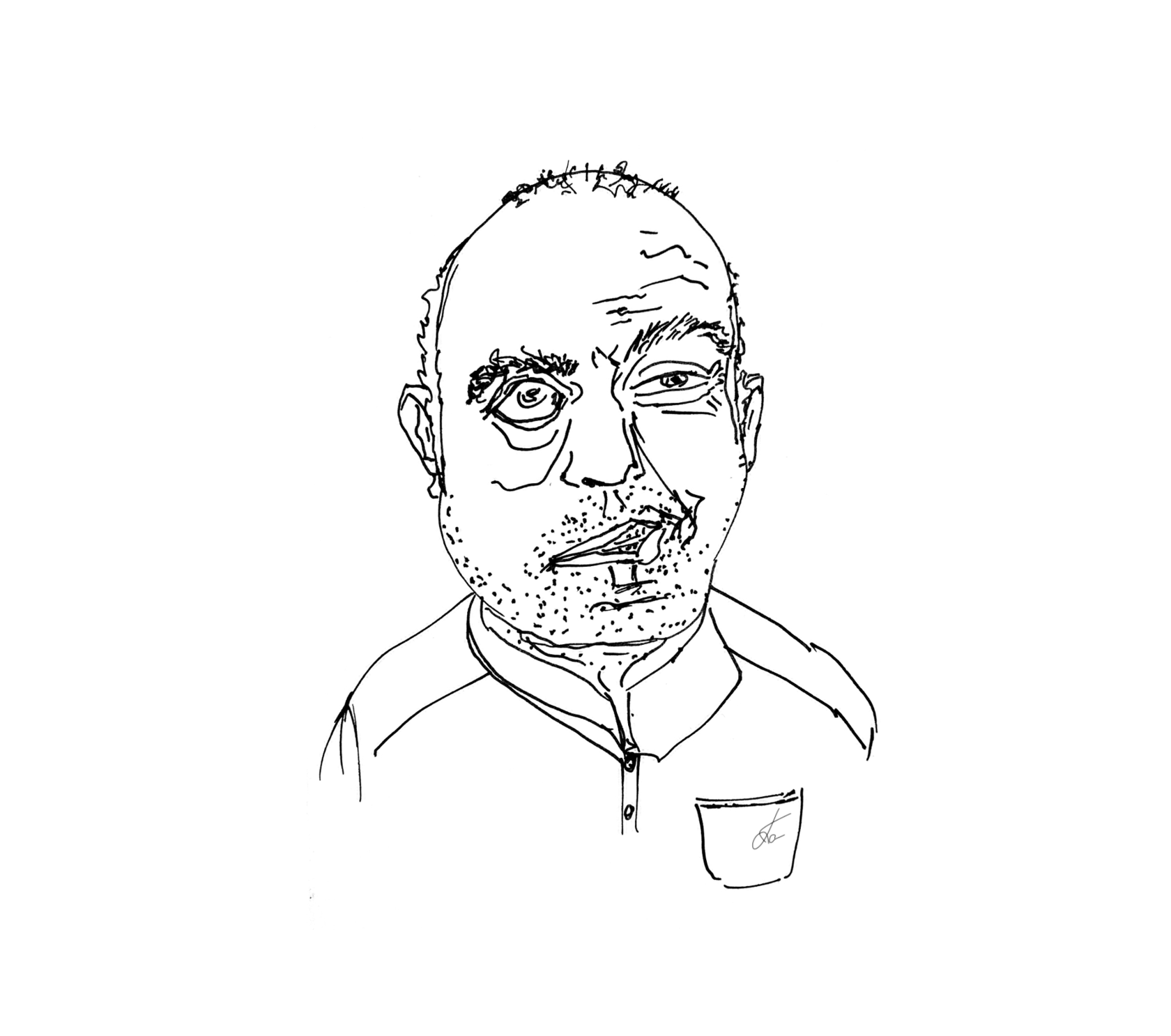 Причины пареза лицевого нерва