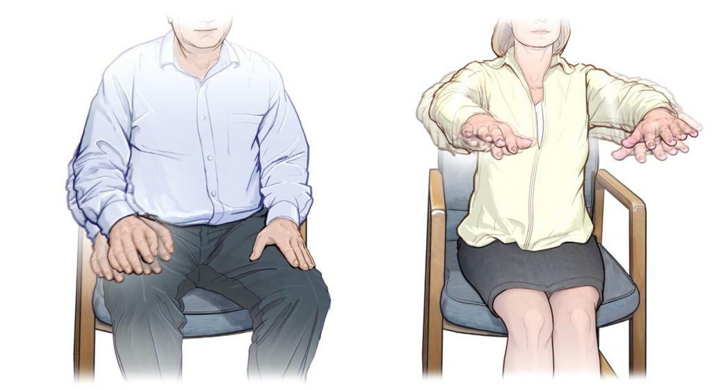 Тремор | Лечение тремора, причины, диагностика | Тремор рук, головы ...