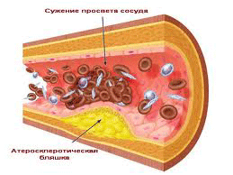 Холестерин